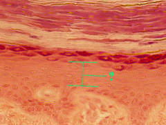 <p>identify the indicated layer of thick skin</p>