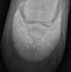 <p>Diagnosis?</p>