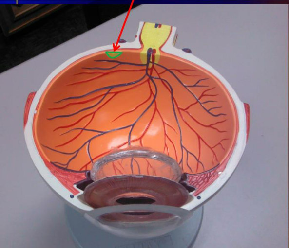 <p>What is that small yellow area</p>
