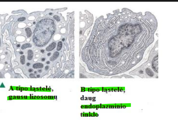 <ul><li><p>A tipo → panašūs į makrofagus; turi Goldžio kompleksą ir lizosomas</p></li><li><p>B tipo → panašūs į fibroblastus; turi GET</p></li></ul><p></p>