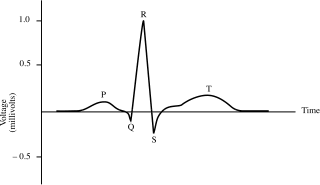<p>What phase on the graph <span>represents the time it takes for electrical conduction to pass from the SA to the AV node</span></p>
