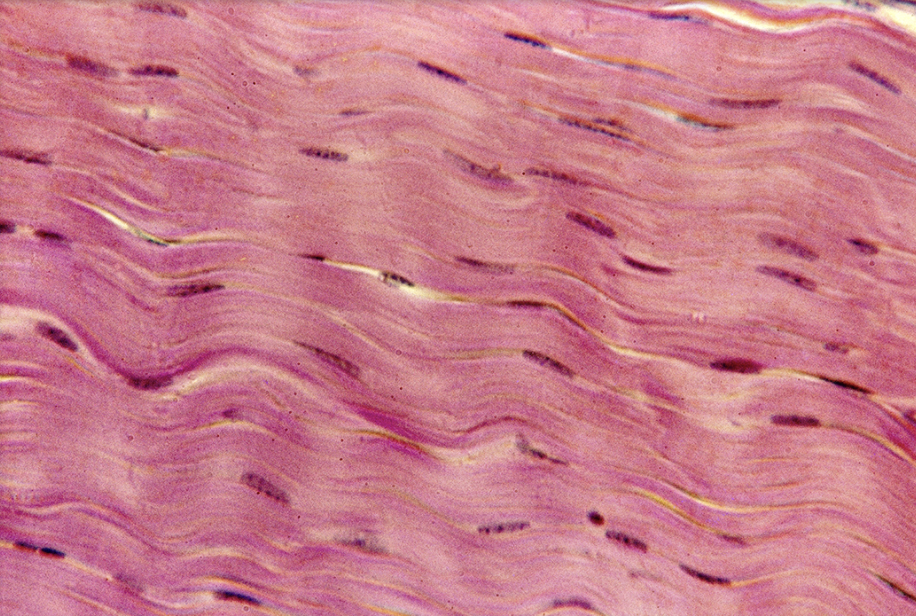 <p><span style="background-color: transparent;">tissue function</span></p>