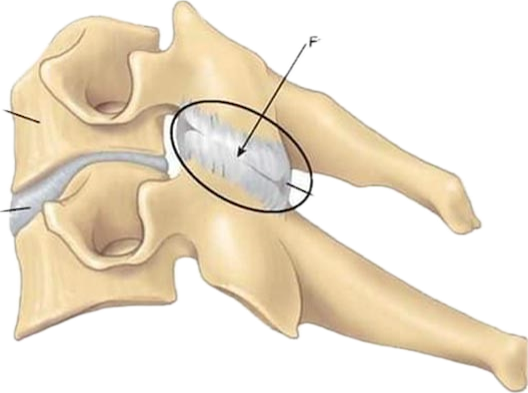 <p>What type of joint is zygapophyseal joint?</p>