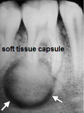 <p>Describe the periphery/borders of the lesion: (4)</p>
