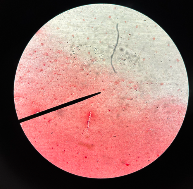 <p>What gram stain is this?</p>