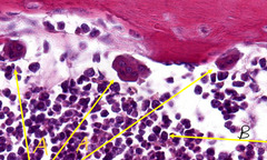 <p>What type of tissue is indicated by the arrows labeled 'B' in this slide of canine claw?</p>