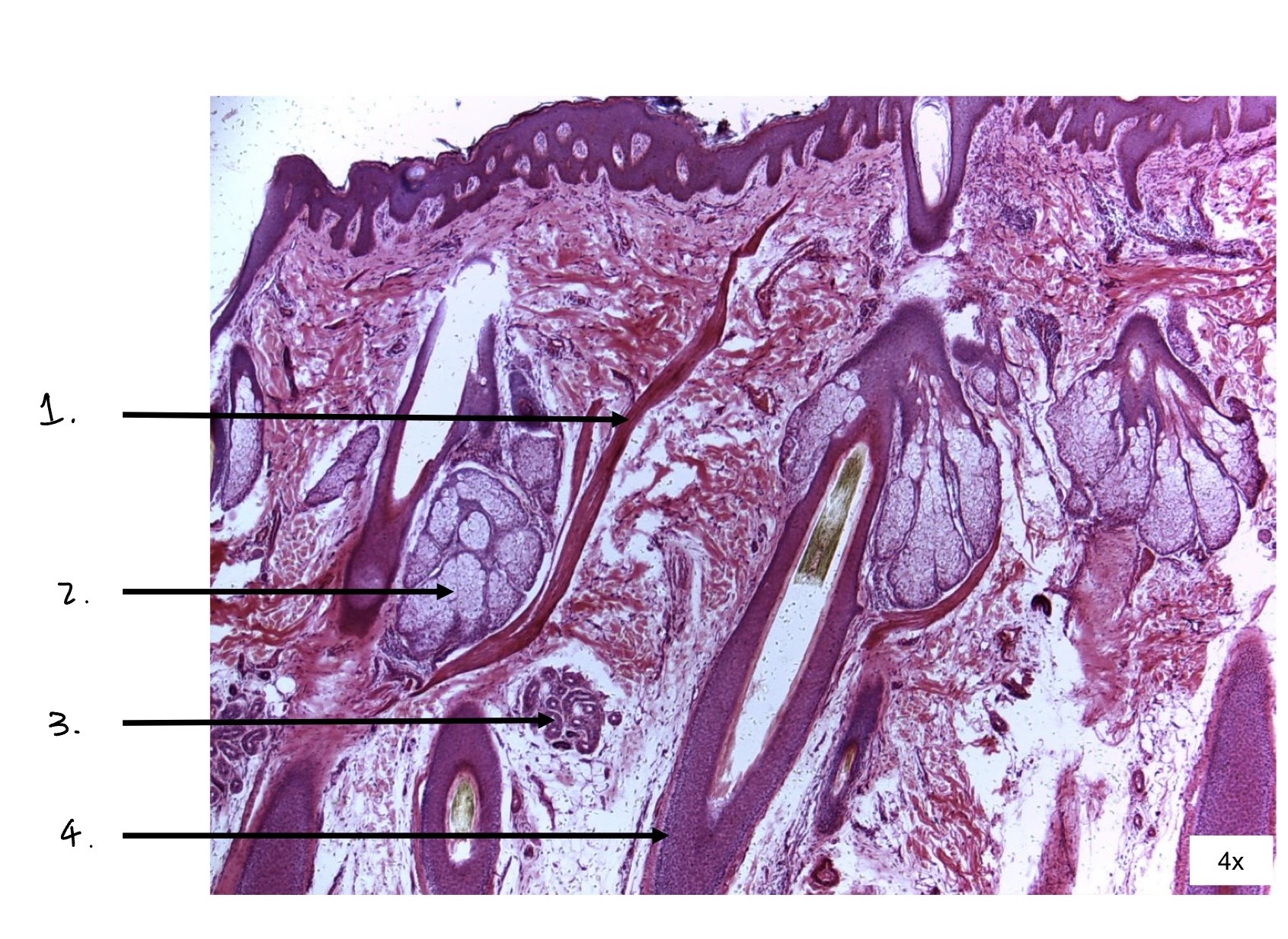 term image