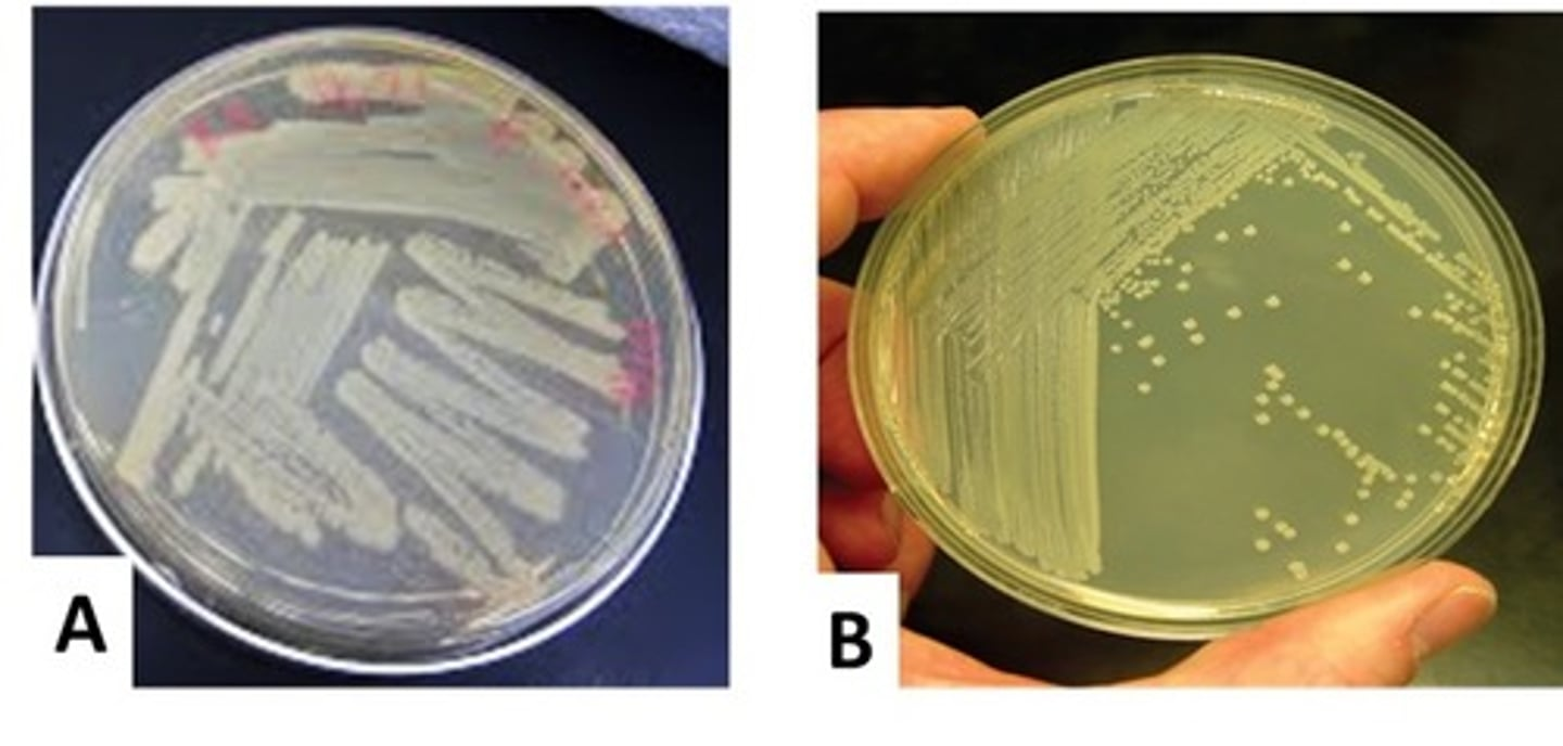 <p>If you performed a quadrant streak plate and obtained the result shown in "A" rather than the desired result shown in "B", then you probably...</p><p>A. forgot to inoculate each new quadrant with fresh culture.</p><p>B. forgot to flame the wire inoculation loop between quadrant streaks</p><p>C. forgot to streak into the previous quadrant.</p><p>D. used the wrong culture for streaking the plate.</p><p>E.forgot to streak with your loop in one continuous motion.</p>