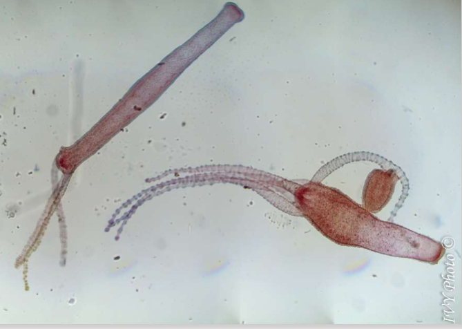 <p>Which is the Hydra with the asexual bud (asexual reproduction)?</p>