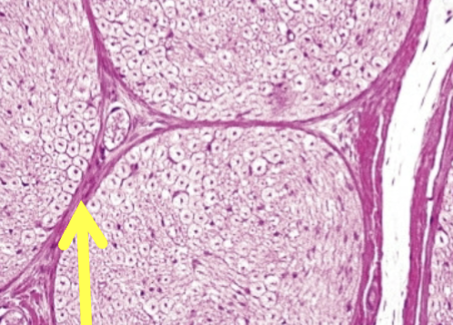 <p>What is the yellow arrow pointing to?</p>
