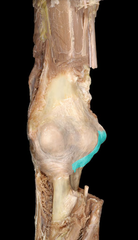 <p>Elbow joint</p>