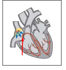 <p>what this (no func needed)</p>