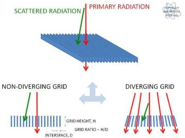 <p>used to reduce amount of scatter reaching a detector<br>in order to remove attenuation from the bars, the grid can be rapidly shifted during acquisition (performed by the Bucky)</p>