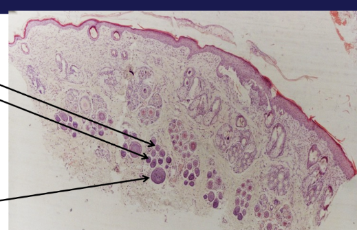 <p>Which hairs are pirmary, which are secondary</p>