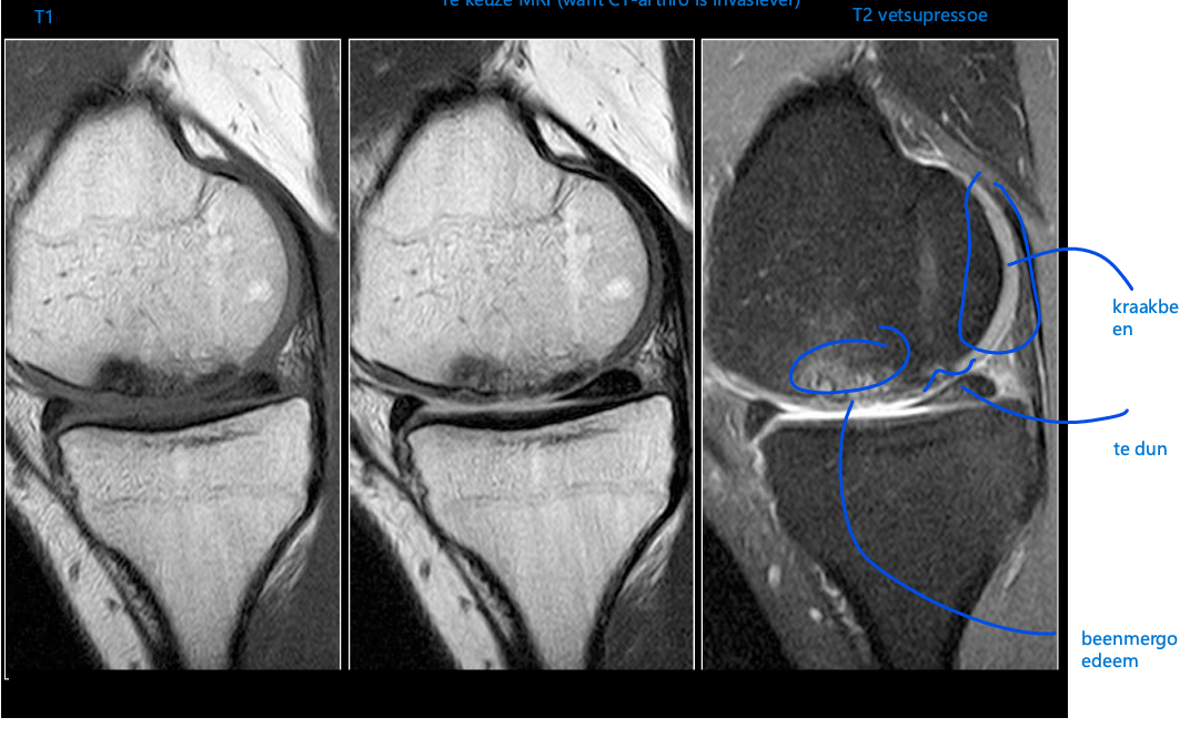 <p>MRI</p>