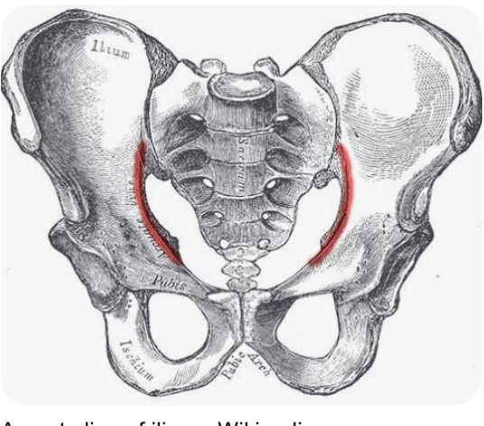 <p>Name this part of the pelvic bone</p>