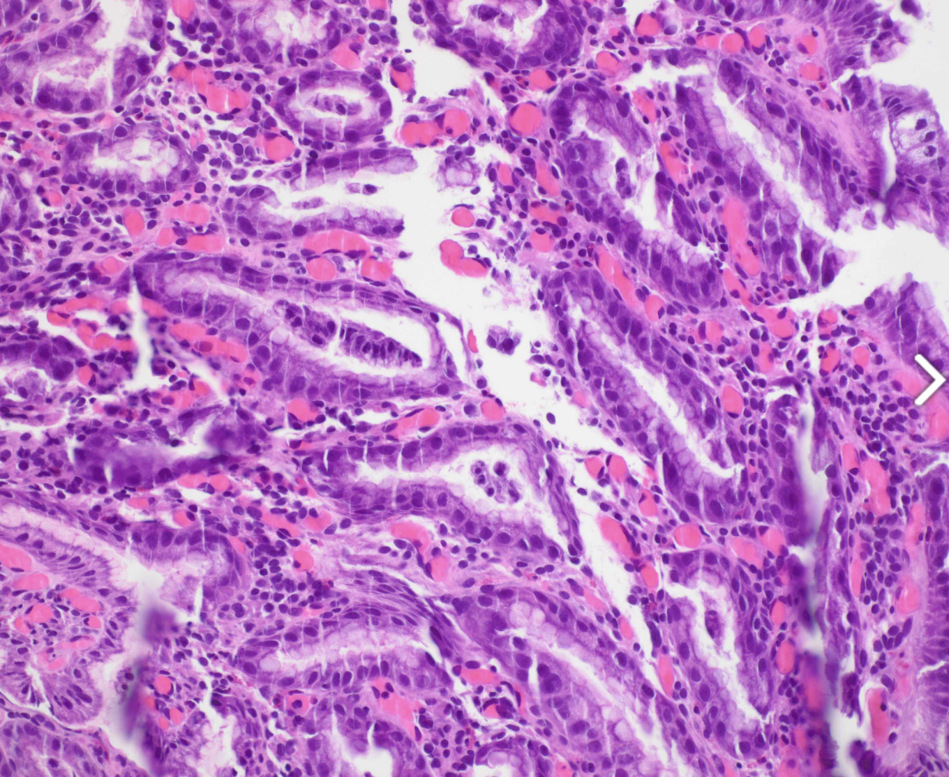 <p>diagnostic, estomac</p>