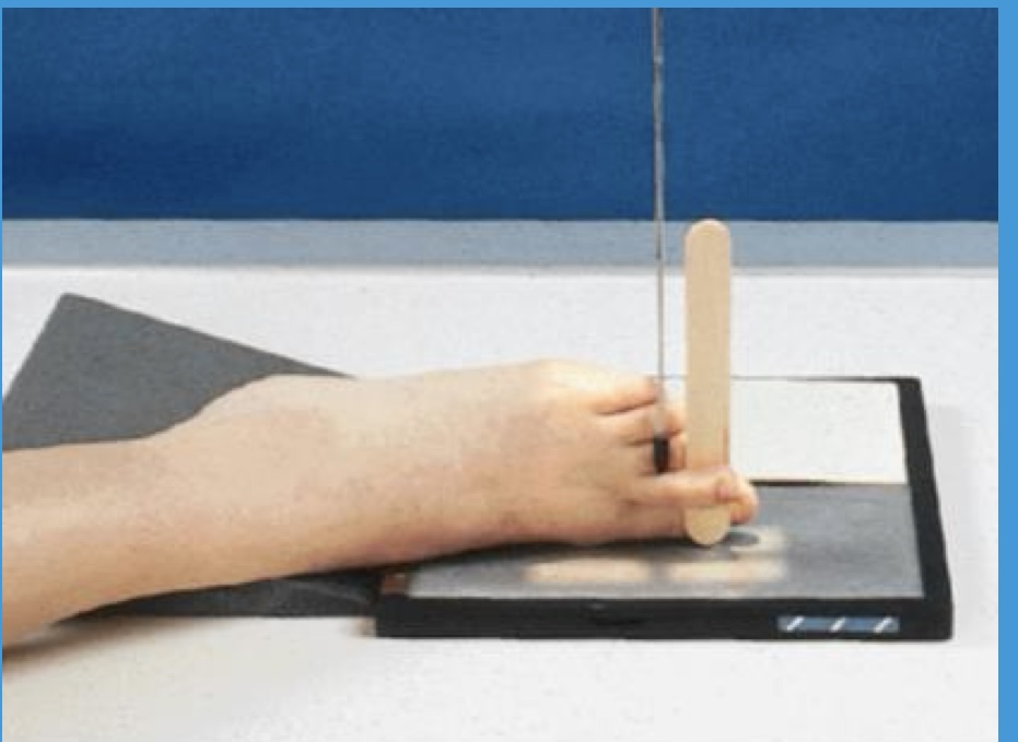 <p>What projection is shown?</p>