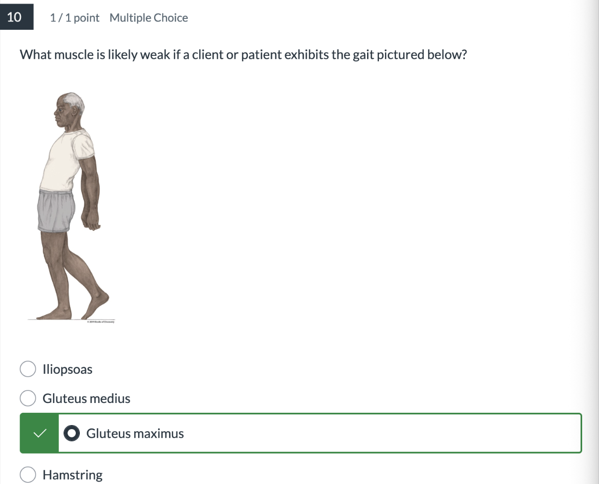 <p><span>What muscle is likely weak if a client or patient exhibits the gait pictured below?</span></p>