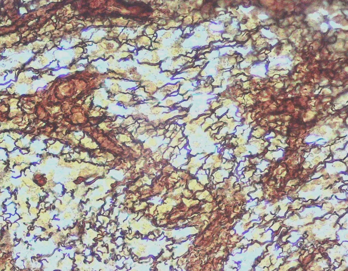 <p><span>Identify the tissue in the micrograph.</span></p>