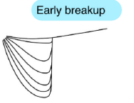 <p>Early breakup: Frontal passages, Föhn onsets</p>