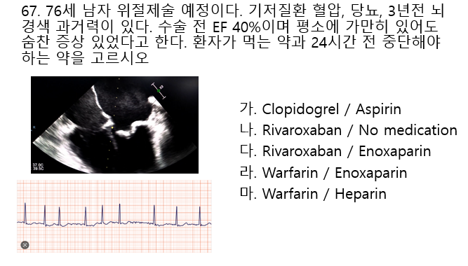 <p>심초음파상 MV가 지저분함</p>