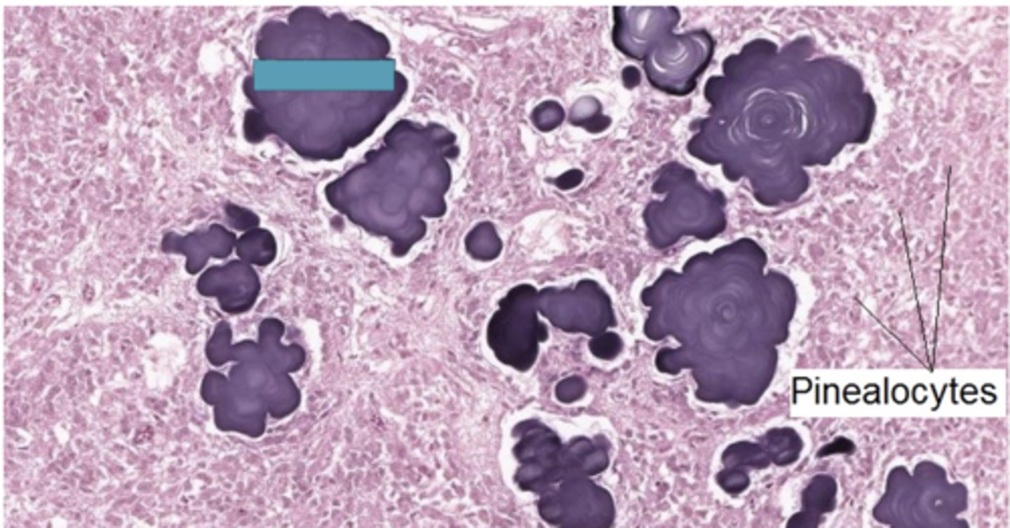 <p>Identify the structure</p>
