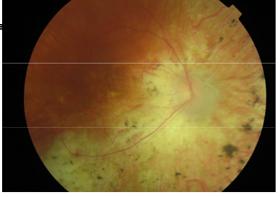 <p>Name the condition</p>