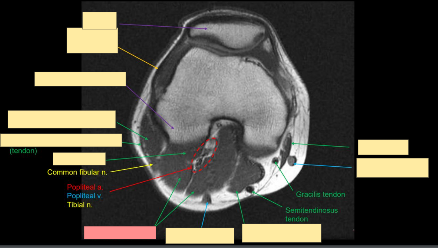 <p>Identify this structure</p>