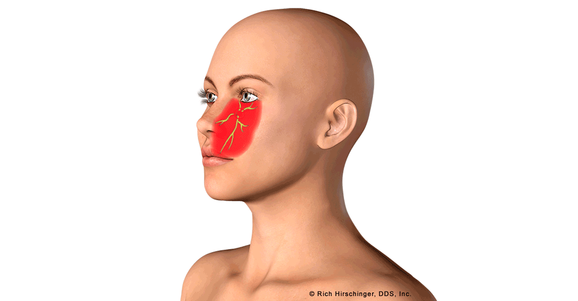 <p>What landmarks are anesthetized with an infraorbital block?</p><p>teeth, tissues, skin, and sometimes what</p>