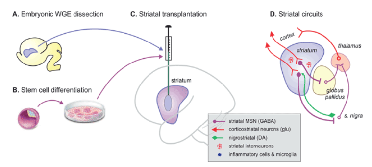<p>treats symptoms-</p><p>mood disturbances -antipsychotic</p><p>depression- anti-depressants</p><p>impulsiveness/ aggression- anti-epileptics</p><p>dystonia, myoclonus- anti-spasticity/ anti-parkinsonian drugs</p><p>chorea- dopamine blocking agents (DA can reduce effect indirect pathway)</p><p></p><p>or cell transplantation/ antisense oligonucleotide/ uniQure</p>