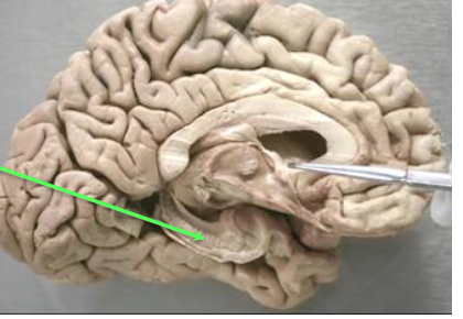 <p>Can you label the limbic lobe?</p>