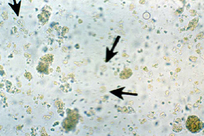 <p>Identify the parasite</p>