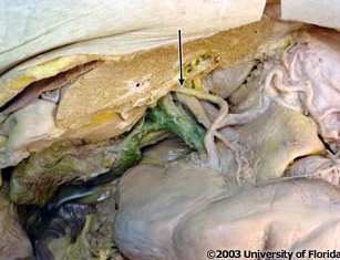 <p>what artery is being indicated to in the image?</p>