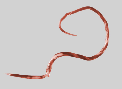 <p>Identify this threadworm: the defining morphological characteristic?</p>