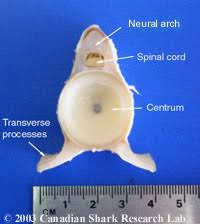 <p>-- <span style="background-color: transparent;">Neural arch (holds spinal cord)</span></p><p><span style="background-color: transparent;">-- Central arch (central part excluding notochord)</span></p><p><span style="background-color: transparent;">-- hemal arch (caudal artery; in tail vertebrae)</span></p><p><span style="background-color: transparent;">-- transverse process (in trunk vertebrae; 2 hooks or points)</span></p>