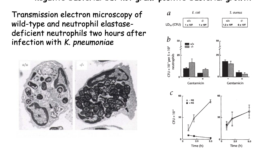 <p><span>Neutrophil Elastase is critically required for controlling gram-negative bacterial but not gram-positive bacterial growth</span></p><p><span>Transmission electron microscopy of wild-type and neutrophil elastase-deficient neutrophils two hours after</span><br><span>infection with K. pneumoniae</span></p>