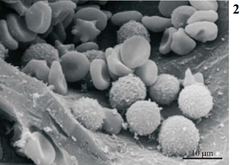 <p>An electron microscope used to study the fine details of cell surfaces</p>