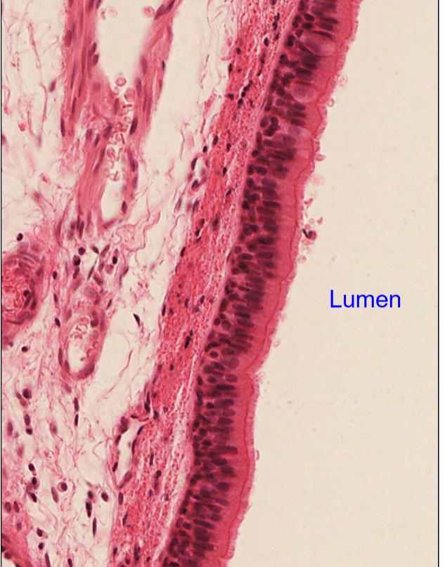 <p>Identify the cell type nand where</p>