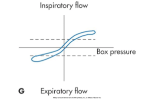 <p>which type fo dx tracing </p>