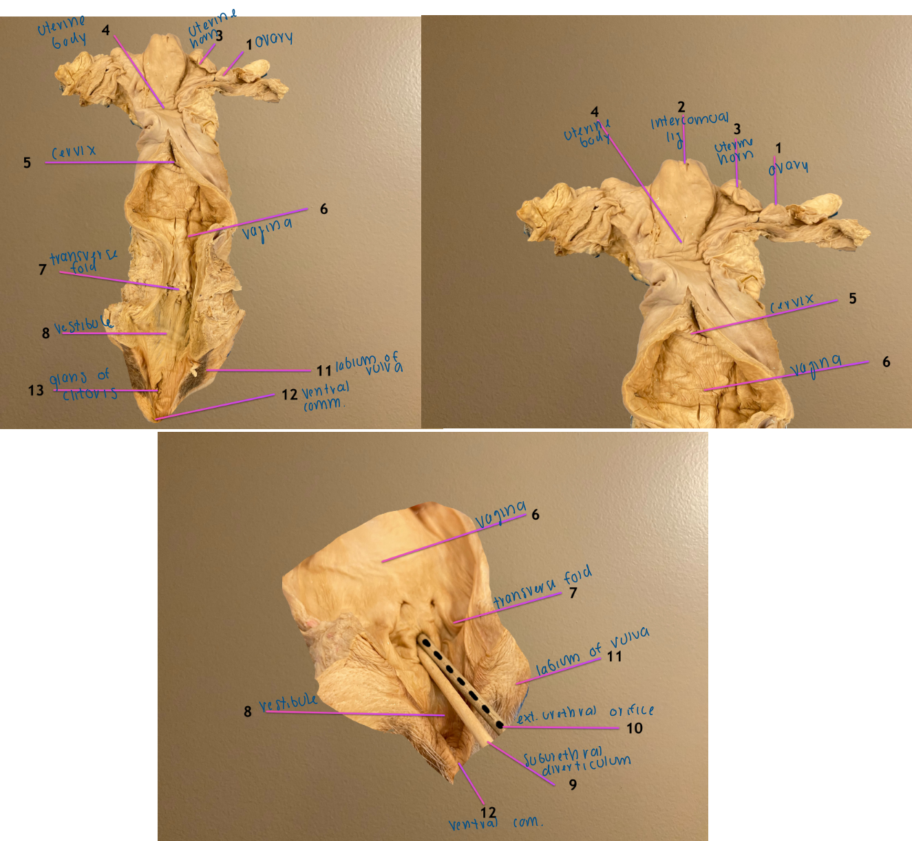<ol start="9"><li><p>suburethral diverticulum: ventral to 10</p></li><li><p>external urethral orifice: dorsal to 9</p></li></ol><ol start="13"><li><p>glans of the clitoris</p></li></ol><p></p>