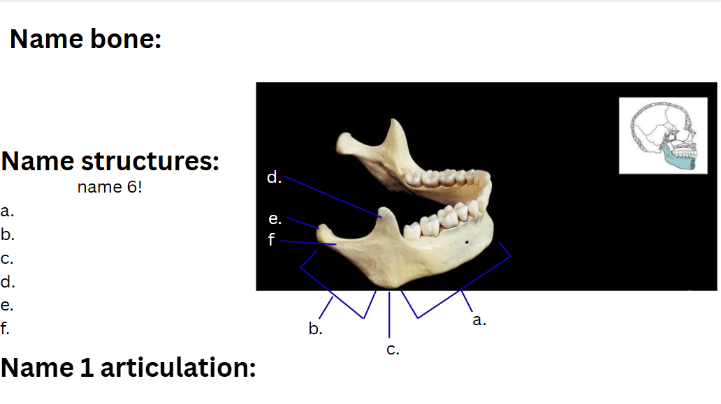 <p>Bone?</p>