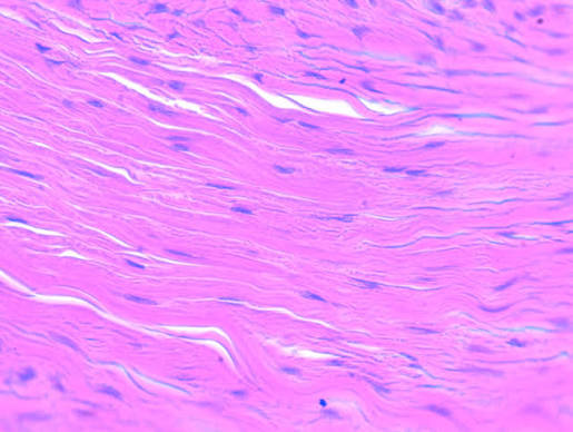 <p>Dense connective tissue tendon</p>