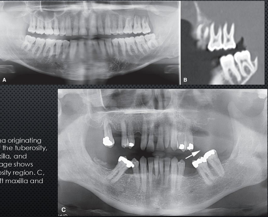 term image
