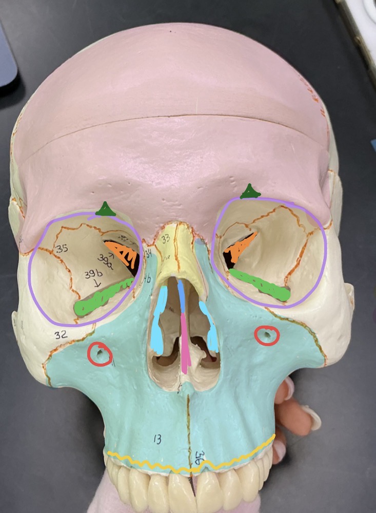 <p>what are the red circled structures?</p>