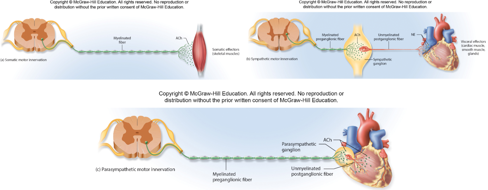 <p>Preganglionic fiber</p>