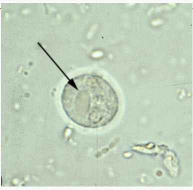 <p>seen in stool microscopic examination</p>