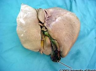 <p>what structure is being indicated to (be specfic)?</p>