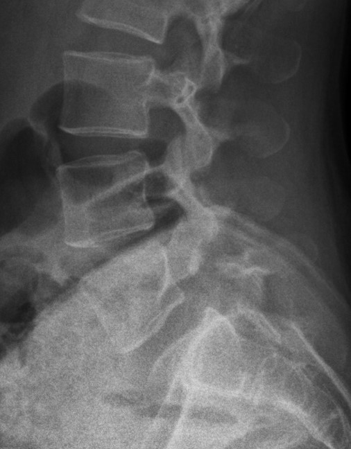 <p>What is the diagnosis?</p>