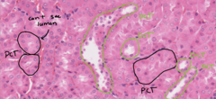 <p>DCT has thinner epithelium and a more evident lumen</p>